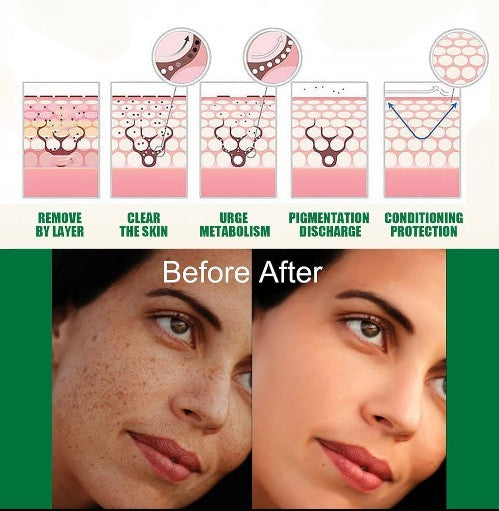 Eelhoe All-in-One Dark Spot & Pore Correcting Serum Eelhoe