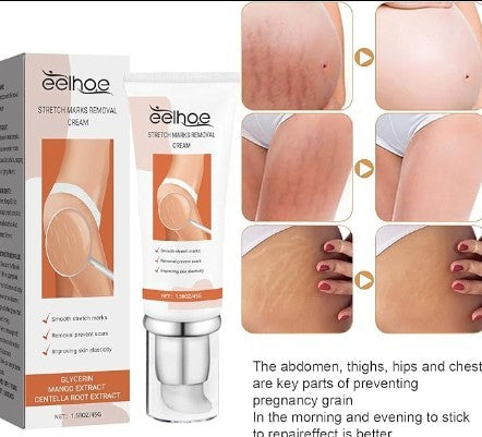 EELHOE Stretch Mark Repair & Prevention Cream | 45g Eelhoe