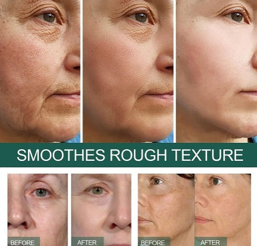 Eelhoe All-in-One Dark Spot & Pore Correcting Serum Eelhoe