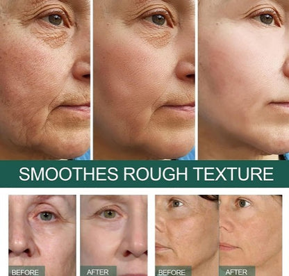 Eelhoe All-in-One Dark Spot & Pore Correcting Serum Eelhoe